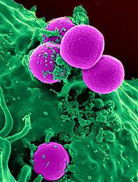 micrograph of neutrophil ingesting staph bacteria